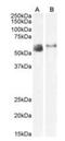 Y+L amino acid transporter 1 antibody, orb2056, Biorbyt, Western Blot image 