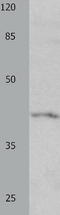 Potassium voltage-gated channel subfamily A member 5 antibody, TA323043, Origene, Western Blot image 