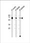 Putative gamma-glutamyltranspeptidase 3 antibody, PA5-72347, Invitrogen Antibodies, Western Blot image 