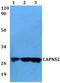 Calpain Small Subunit 2 antibody, PA5-75735, Invitrogen Antibodies, Western Blot image 