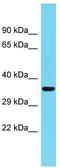 Uncharacterized protein C1orf222 antibody, TA334857, Origene, Western Blot image 