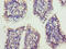 X-Ray Radiation Resistance Associated 1 antibody, LS-C399090, Lifespan Biosciences, Immunohistochemistry paraffin image 