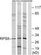 Ribosomal Protein S8 antibody, GTX87428, GeneTex, Western Blot image 