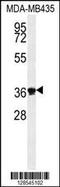 Exonuclease 5 antibody, MBS9213857, MyBioSource, Western Blot image 