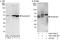 Dystrobrevin Binding Protein 1 antibody, A303-360A, Bethyl Labs, Immunoprecipitation image 