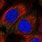 Zinc Finger DHHC-Type Containing 1 antibody, HPA042531, Atlas Antibodies, Immunocytochemistry image 