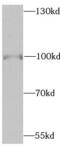 Serine/threonine-protein kinase B-raf antibody, FNab00941, FineTest, Western Blot image 