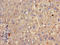 Gamma-Glutamyltransferase 1 antibody, orb400592, Biorbyt, Immunohistochemistry paraffin image 