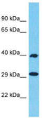 Olfactory Receptor Family 1 Subfamily N Member 2 antibody, TA337478, Origene, Western Blot image 