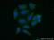 Major Histocompatibility Complex, Class I, C antibody, 15777-1-AP, Proteintech Group, Immunofluorescence image 