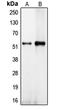 Centrosomal Protein 57 antibody, LS-C353191, Lifespan Biosciences, Western Blot image 