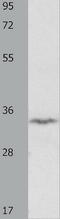 IGFBP-rP1 antibody, TA323151, Origene, Western Blot image 