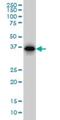 RP2 Activator Of ARL3 GTPase antibody, H00006102-M02, Novus Biologicals, Western Blot image 