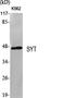 SS18 Subunit Of BAF Chromatin Remodeling Complex antibody, A03947, Boster Biological Technology, Western Blot image 