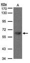 Transducin Beta Like 1 X-Linked antibody, GTX107736, GeneTex, Western Blot image 