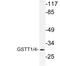 Glutathione S-Transferase Theta 1 antibody, LS-C177844, Lifespan Biosciences, Western Blot image 