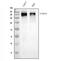 Chromodomain Helicase DNA Binding Protein 2 antibody, A04079-2, Boster Biological Technology, Western Blot image 
