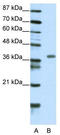 Homeobox protein MOX-2 antibody, TA331115, Origene, Western Blot image 