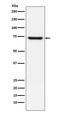 Telomeric Repeat Binding Factor 2 antibody, M00650, Boster Biological Technology, Western Blot image 