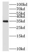 Neugrin, Neurite Outgrowth Associated antibody, FNab05722, FineTest, Western Blot image 