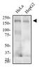 Low Density Lipoprotein Receptor antibody, NBP1-78159, Novus Biologicals, Western Blot image 