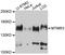 Myotubularin-related protein 3 antibody, abx126196, Abbexa, Western Blot image 
