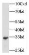 Male-Enhanced Antigen 1 antibody, FNab05081, FineTest, Western Blot image 