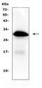 Insulin Like Growth Factor Binding Protein 1 antibody, A00922, Boster Biological Technology, Western Blot image 