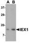 Radiation-inducible immediate-early gene IEX-1 antibody, A04014, Boster Biological Technology, Western Blot image 