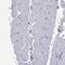 FLJ23834 antibody, NBP1-88100, Novus Biologicals, Immunohistochemistry paraffin image 