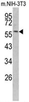 Keratin 14 antibody, AP17528PU-N, Origene, Western Blot image 