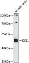 DNA Damage Inducible 1 Homolog 1 antibody, 15-558, ProSci, Western Blot image 