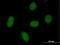 Chromosome 9 Open Reading Frame 152 antibody, H00401546-B01P, Novus Biologicals, Immunocytochemistry image 
