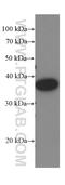 Amphiregulin antibody, 66433-1-Ig, Proteintech Group, Western Blot image 