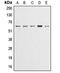 Akt antibody, LS-C351800, Lifespan Biosciences, Western Blot image 