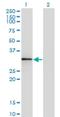 Homeobox protein Hox-B1 antibody, H00003211-M06, Novus Biologicals, Western Blot image 