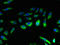C-C Motif Chemokine Receptor 4 antibody, orb23021, Biorbyt, Immunocytochemistry image 