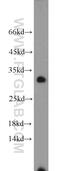 Nucleolar Protein 12 antibody, 15456-1-AP, Proteintech Group, Western Blot image 