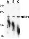 Peptidyl-TRNA Hydrolase 2 antibody, LS-B1392, Lifespan Biosciences, Western Blot image 