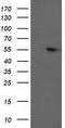 Protein Phosphatase, Mg2+/Mn2+ Dependent 1B antibody, TA503248, Origene, Western Blot image 