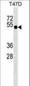 GLI Family Zinc Finger 4 antibody, LS-C159737, Lifespan Biosciences, Western Blot image 