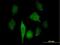 Glyceronephosphate O-Acyltransferase antibody, H00008443-B01P, Novus Biologicals, Immunofluorescence image 