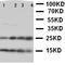 Nucleoplasmin-2 antibody, orb137870, Biorbyt, Western Blot image 