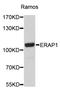 Endoplasmic Reticulum Aminopeptidase 1 antibody, STJ23554, St John