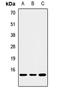 Phorbol-12-Myristate-13-Acetate-Induced Protein 1 antibody, LS-C668202, Lifespan Biosciences, Western Blot image 