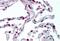 C-C Motif Chemokine Receptor 1 antibody, MBS241826, MyBioSource, Immunohistochemistry paraffin image 