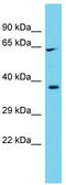 Cytochrome P450 Family 1 Subfamily B Member 1 antibody, TA339935, Origene, Western Blot image 