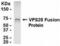 VPS28 Subunit Of ESCRT-I antibody, XW-7975, ProSci, Western Blot image 