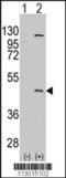 Protein Arginine Methyltransferase 8 antibody, 56-275, ProSci, Western Blot image 