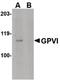 GP6 antibody, PA5-20583, Invitrogen Antibodies, Western Blot image 